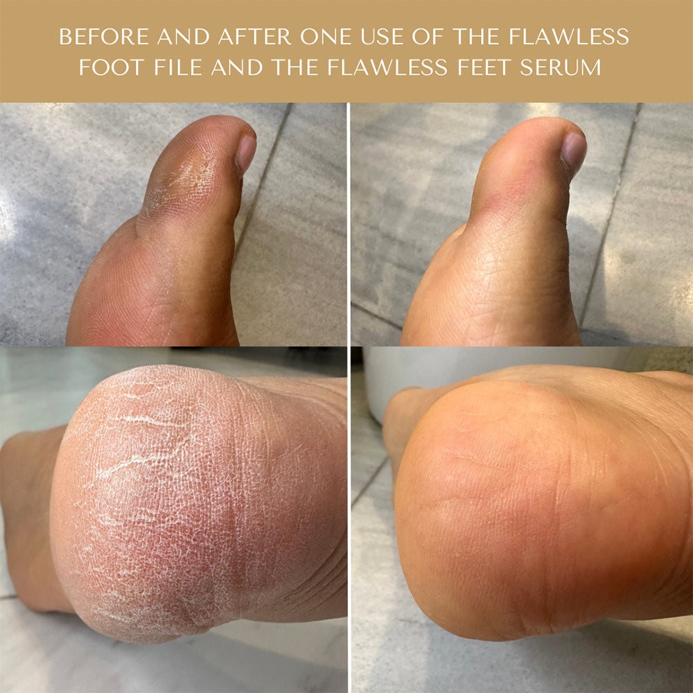 Flawless Foot Serum