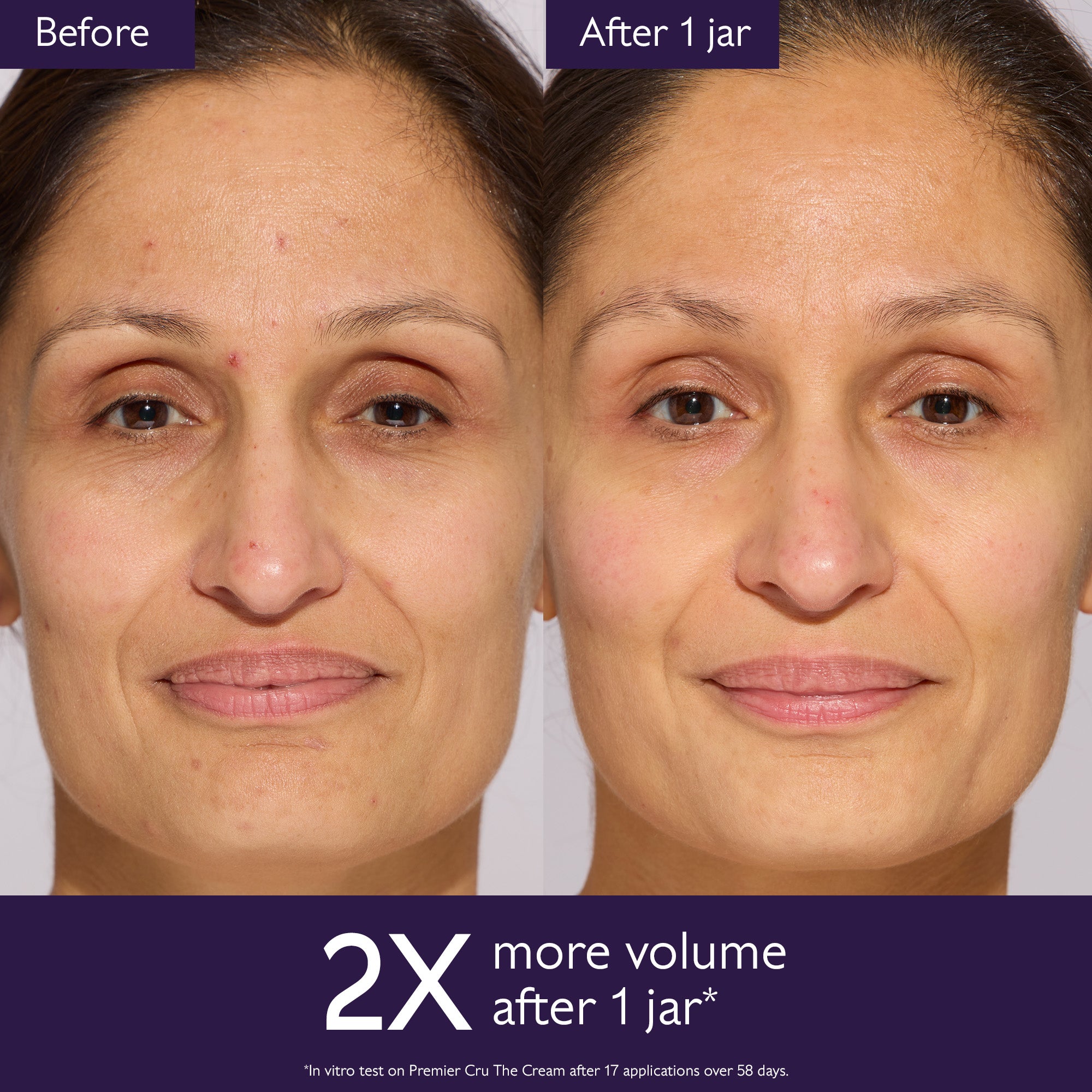 Before and after comparison of a woman's face with text indicating 2X more volume after one jar of product.