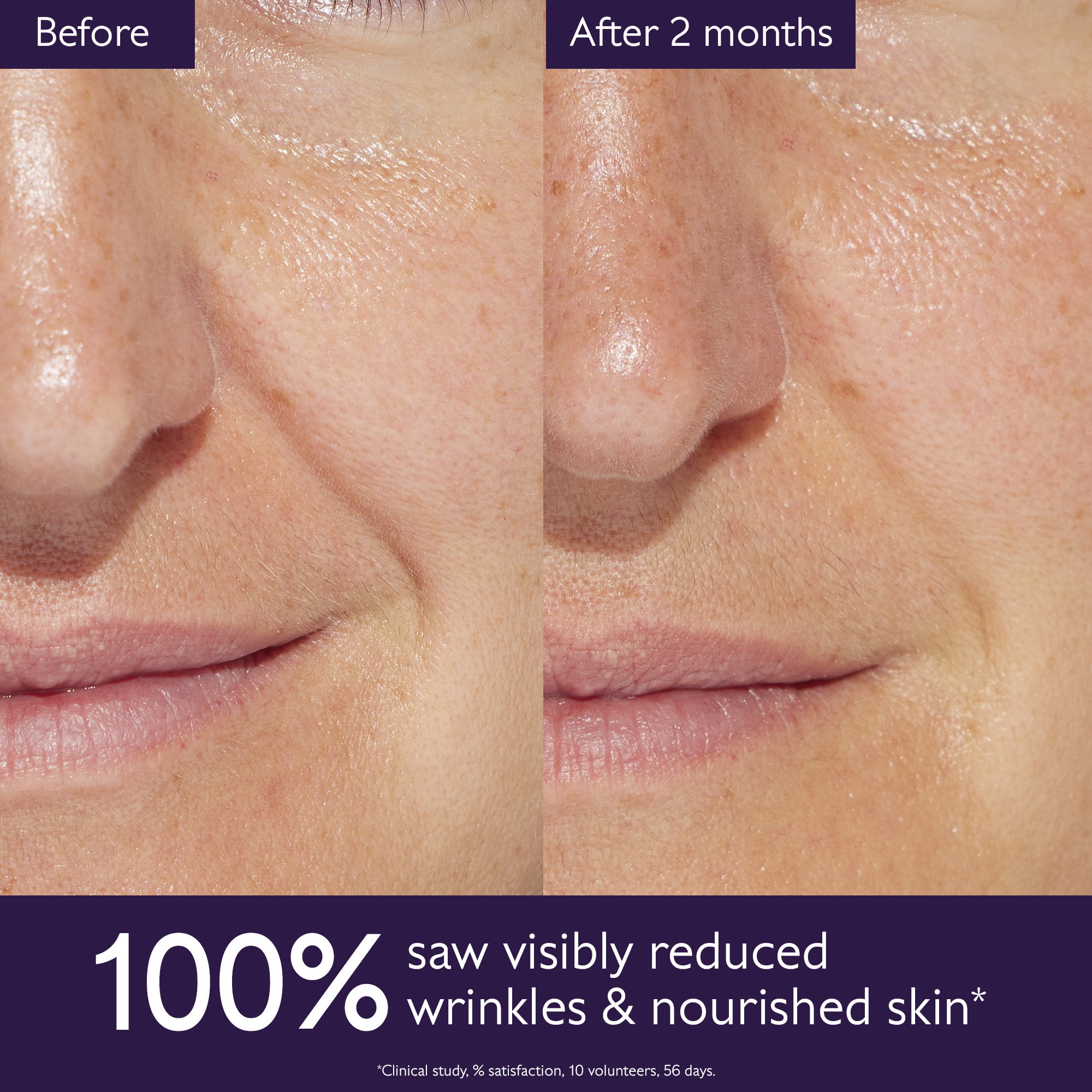 Before and after comparison of skin with reduced wrinkles and nourished appearance.