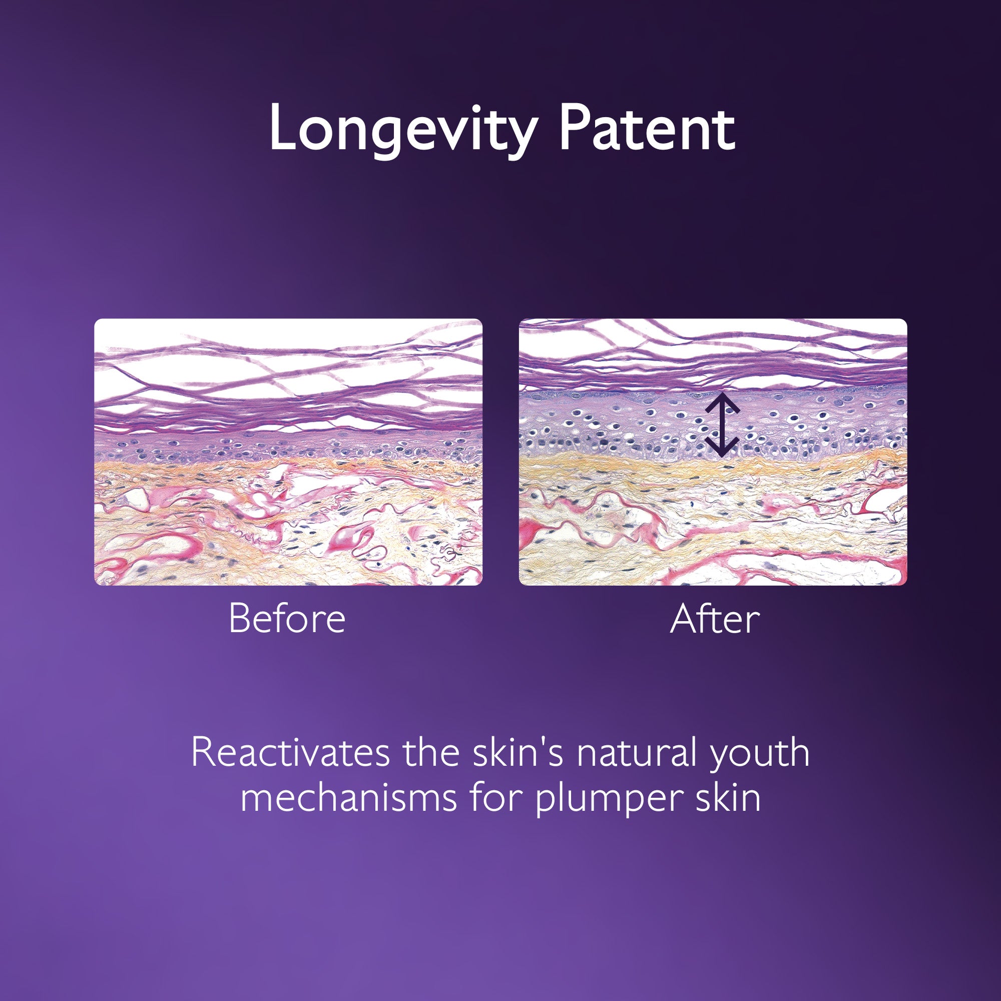Diagram showing skin before and after treatment with 'Longevity Patent' on a purple background.