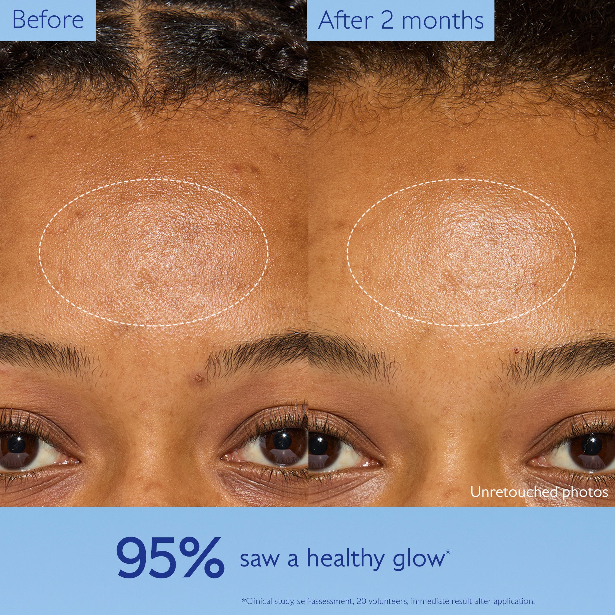 Before and after comparison of a woman's face with a focus on the eye area, showing a healthy glow.