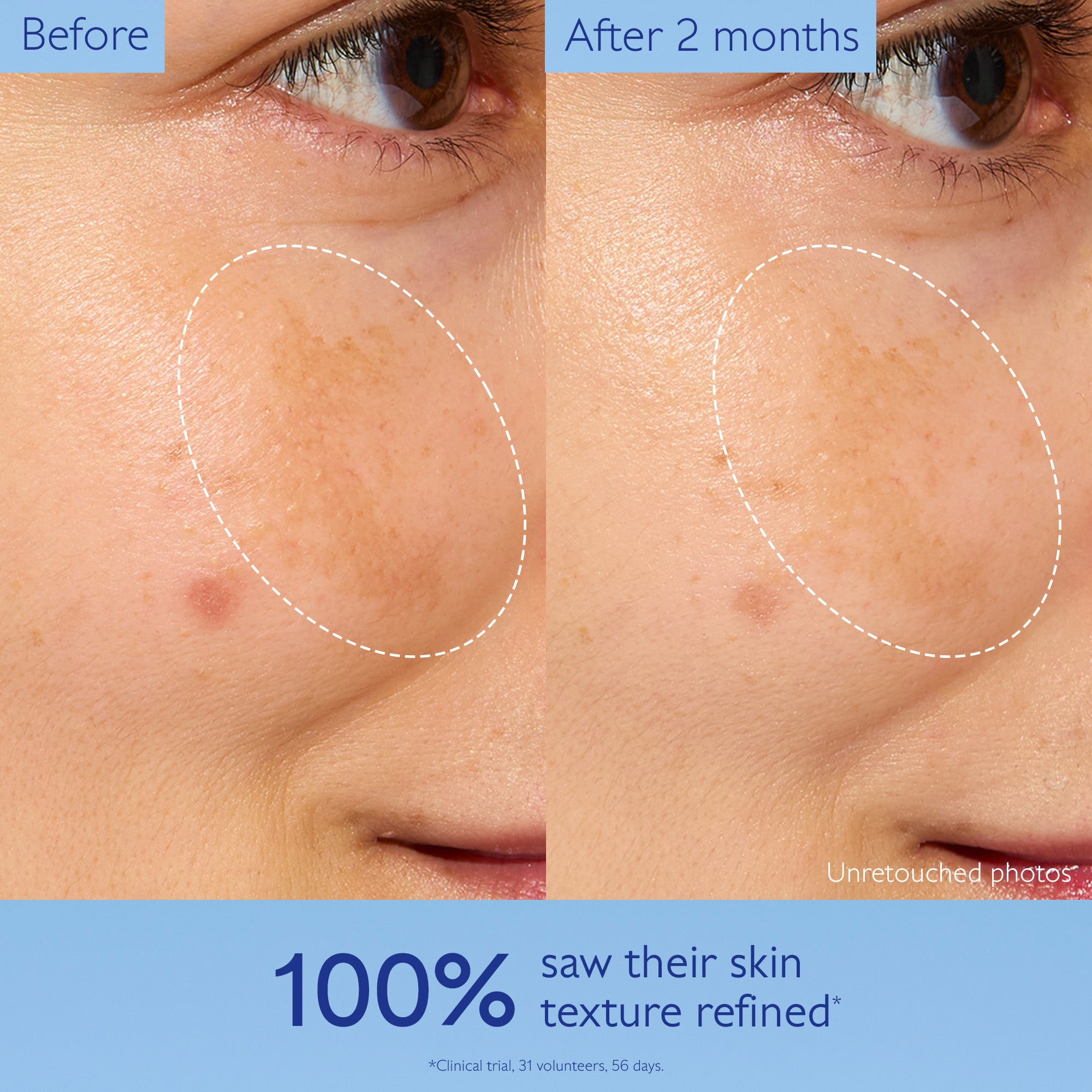 Graphic results of Caudalie results of refined skin texture before and after 