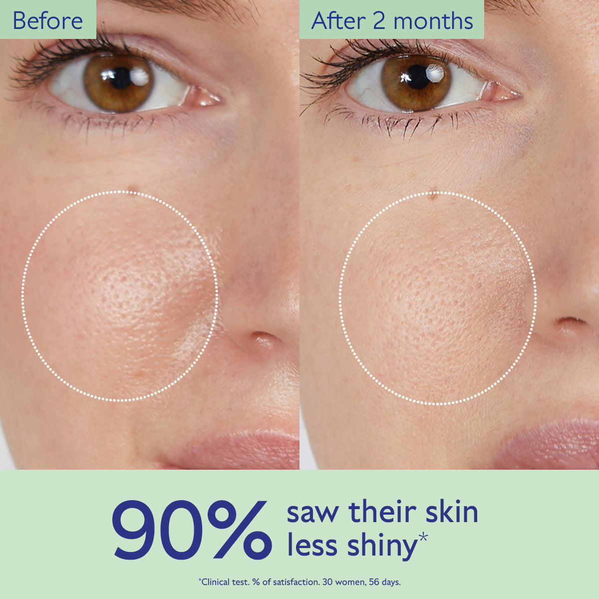 Before and after comparison of skin texture with text indicating improvement.