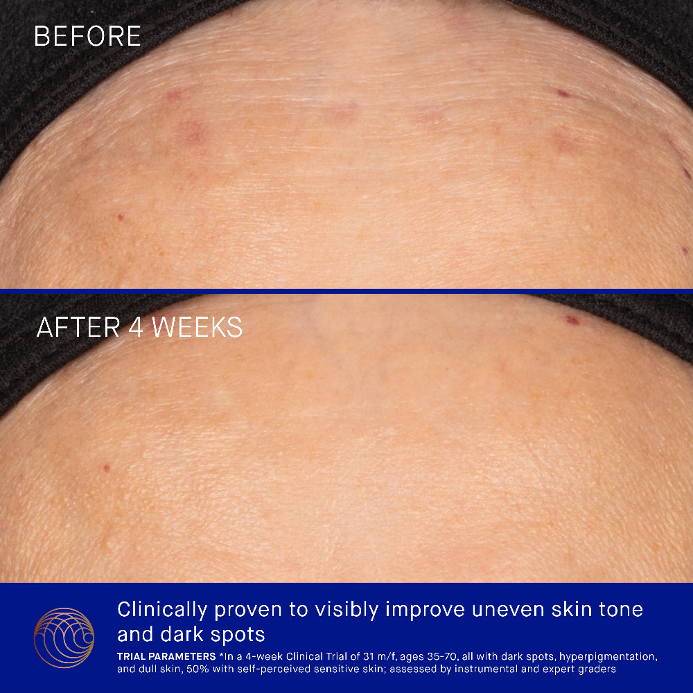 Before and after comparison of skin texture improvement with text indicating results after 4 weeks.