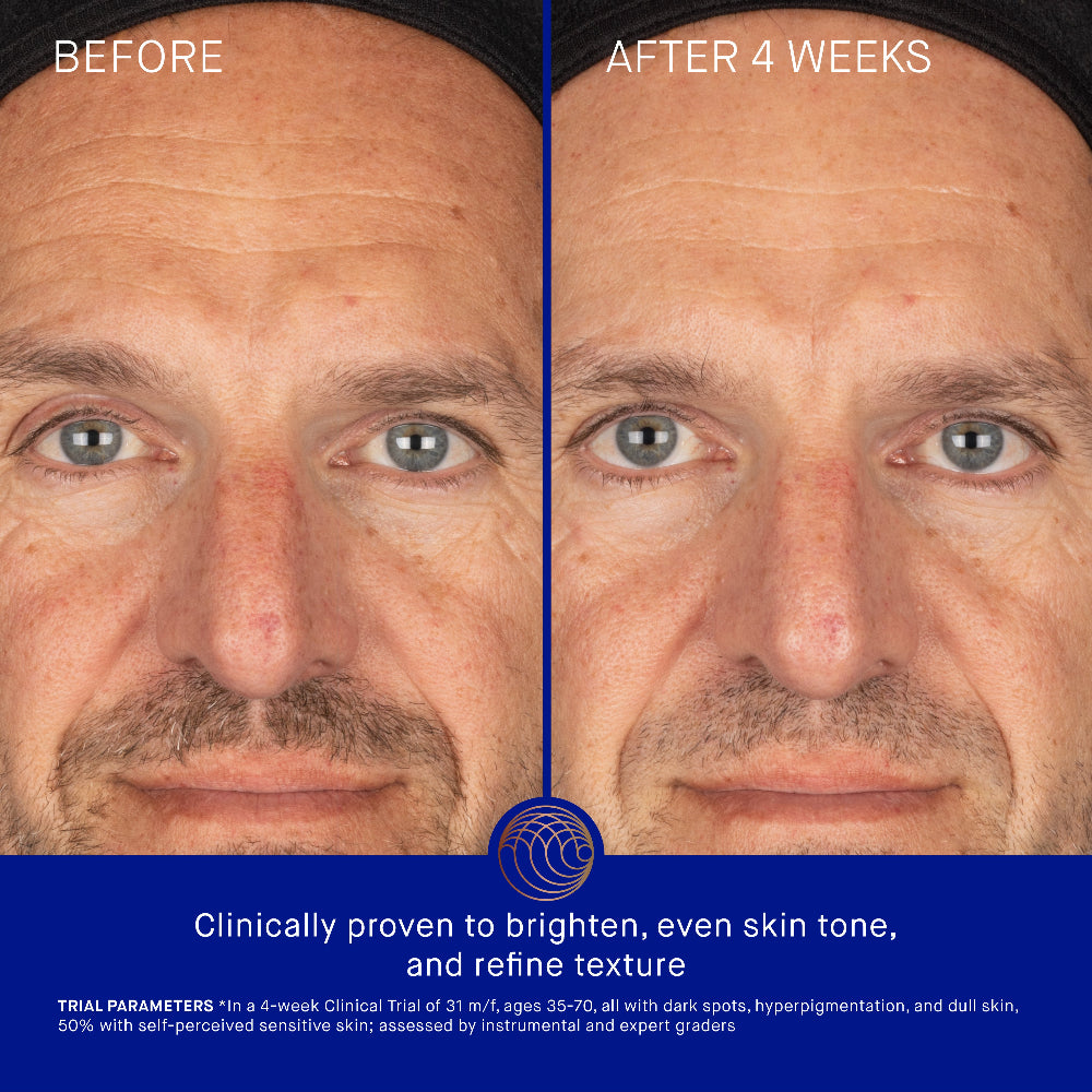 Before and after comparison of a man's face with text indicating clinical proven benefits.