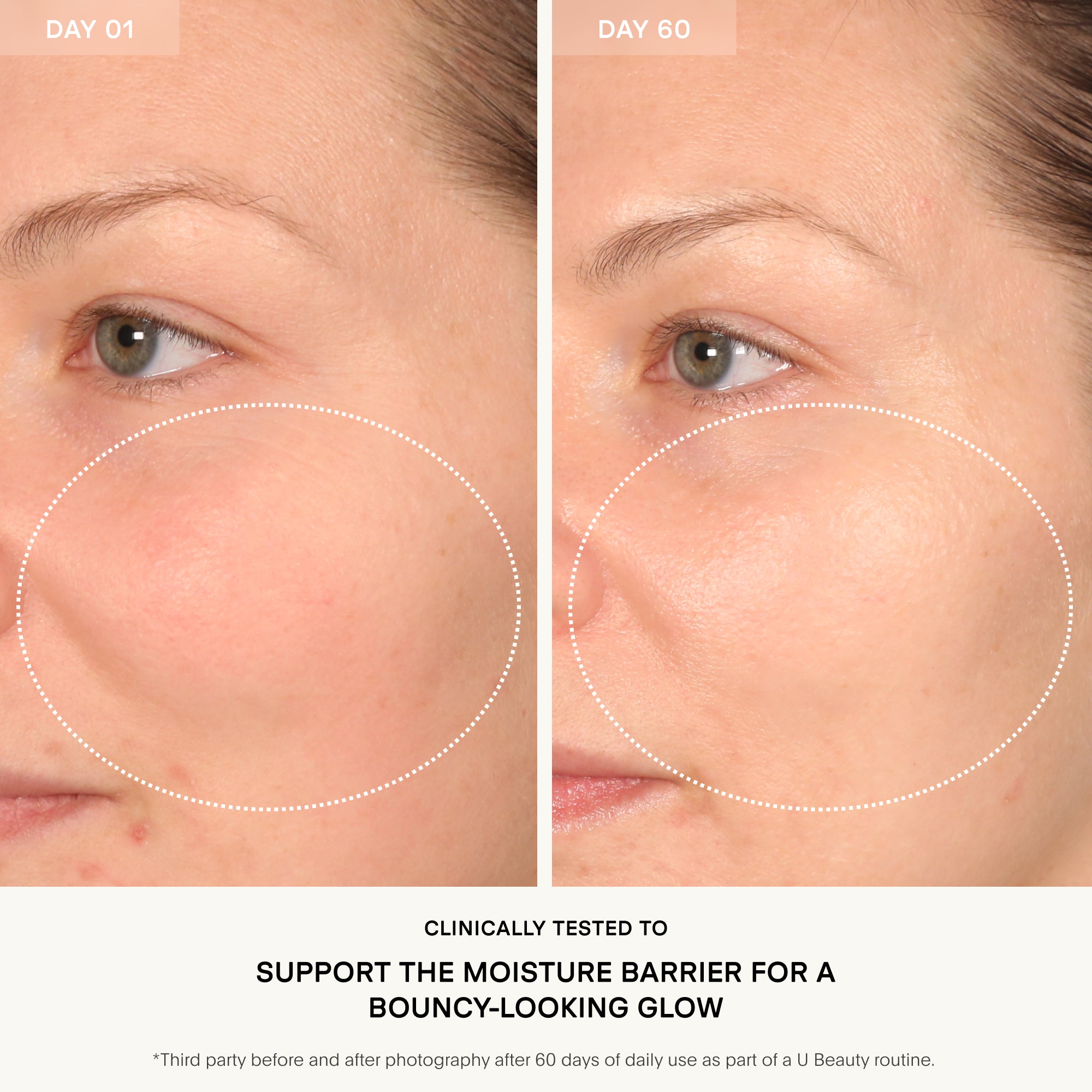 Before and after comparison of a woman's eye area with text about clinical testing for a moisture barrier.