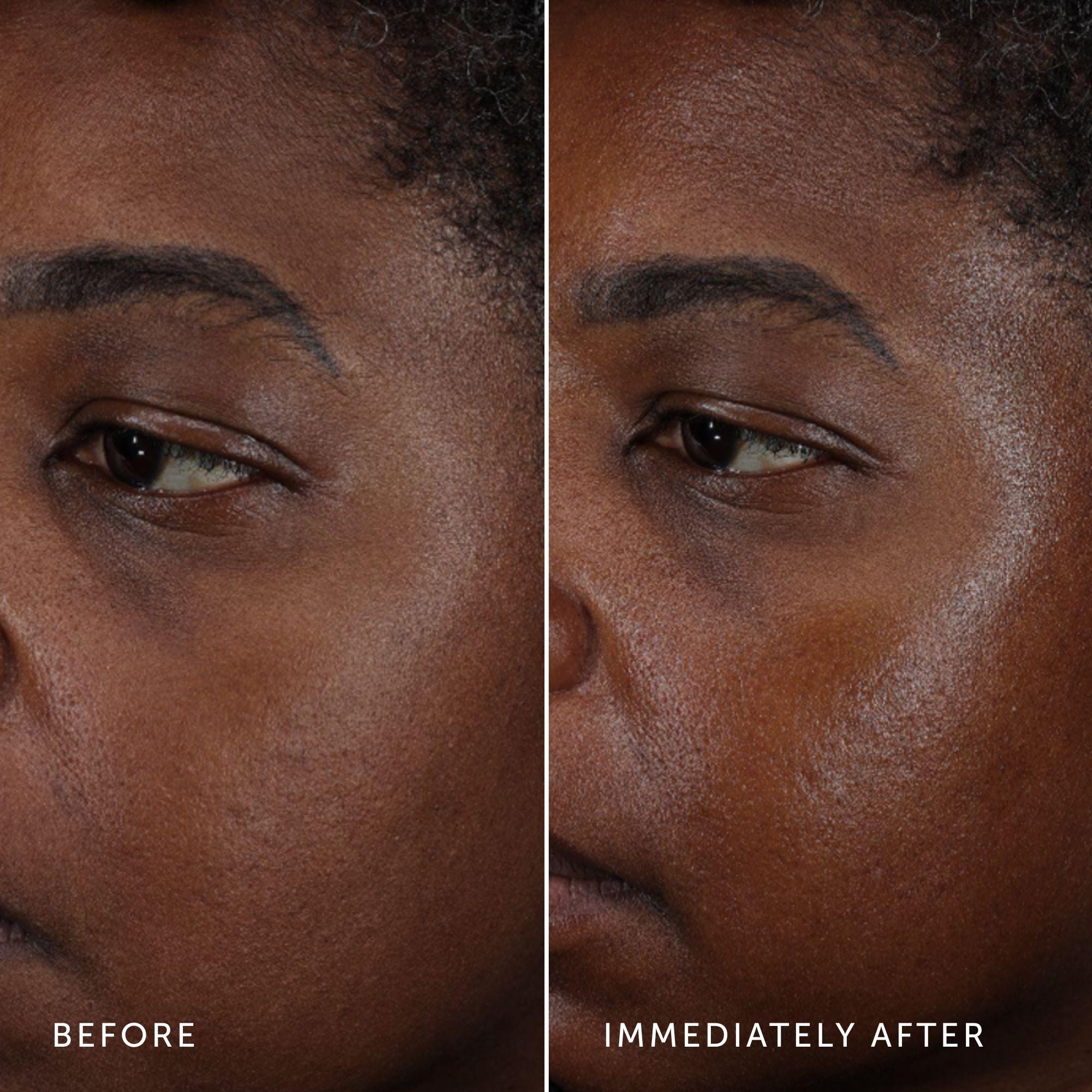 Before and after comparison of a person's face with visible skin texture differences.