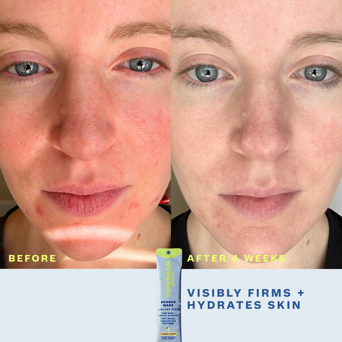 Before and after image of a face showing benefits of Timebeam Beauty - AM Bounce Mode Healthy Pixie after 4 weeks