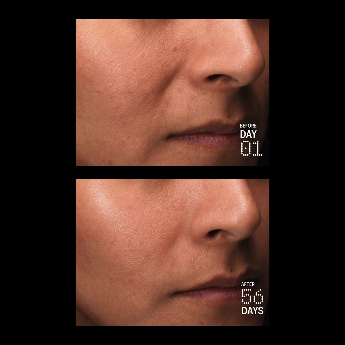 Close up of a person's face before and after using Allies of Skin's Multi Peptides & GF Advanced Lifting Serum. 