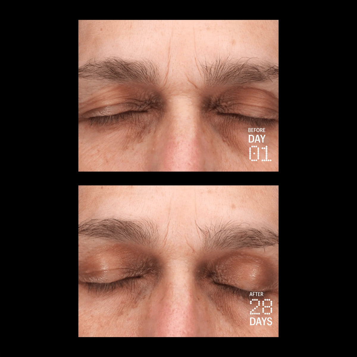 Close up of a person's face before and after using Allies of Skin's Multi Peptides & GF Advanced Lifting Serum. 
