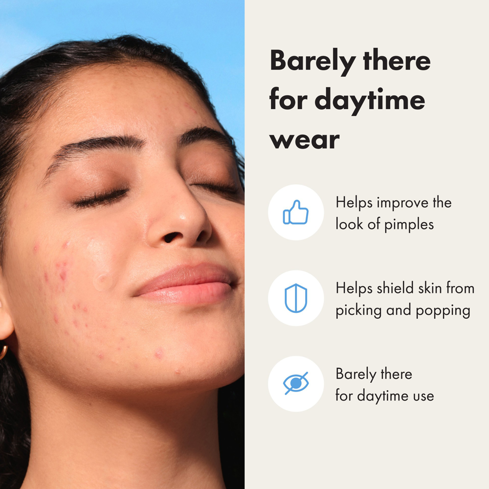 Woman with acne on face and text about skincare product benefits