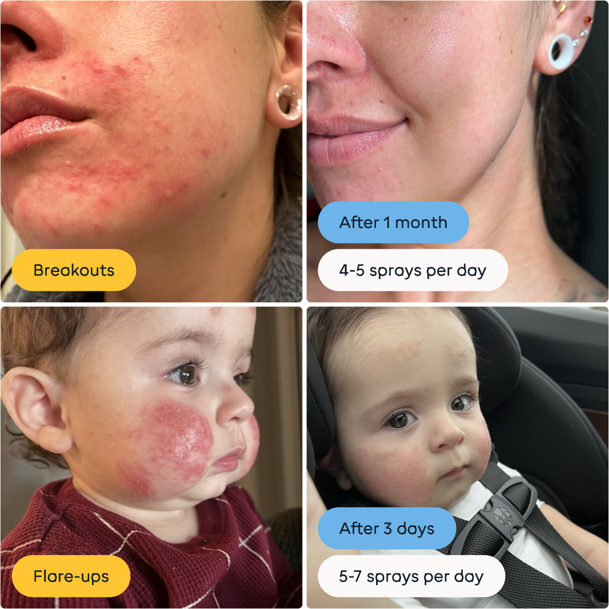Close-ups of users' faces before and after using Magic Molecule Hypochlorous Acid Spray.