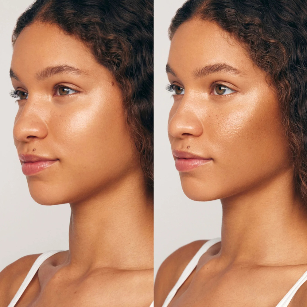 Side-by-side comparison of a woman's face with a neutral background