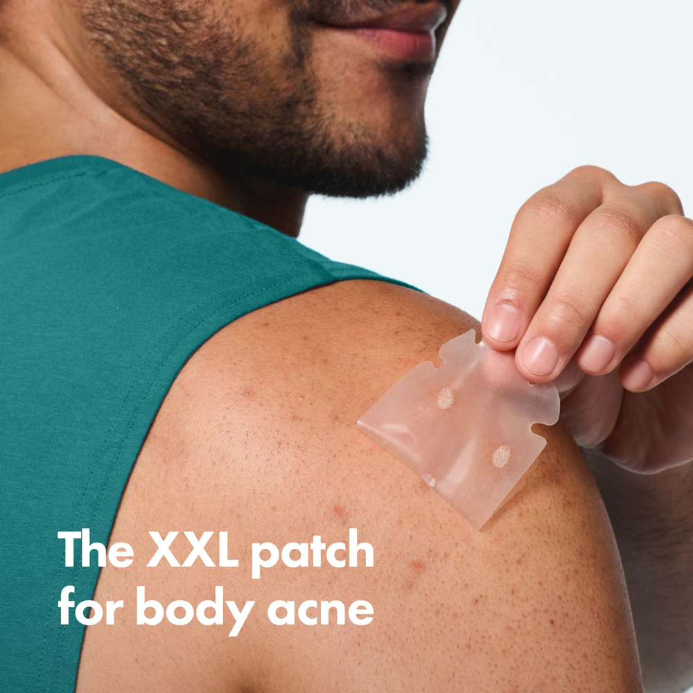 Person applying a large patch to their shoulder with text 'The XXL patch for body acne'.