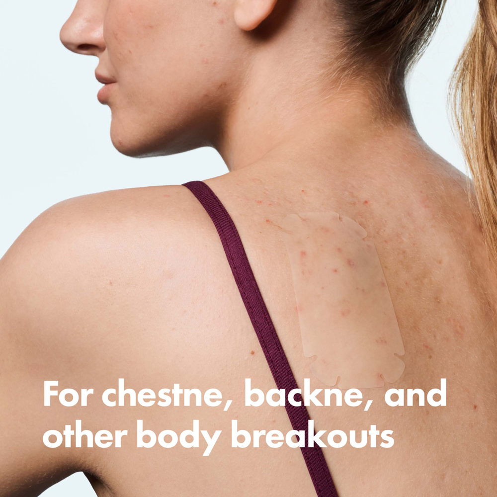 Woman with a patch on her back with text 'For chestne, backne, and other body breakouts'.