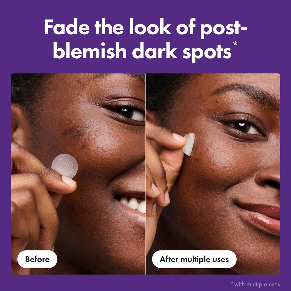 Before and after comparison of a product on a person's skin with a purple background.