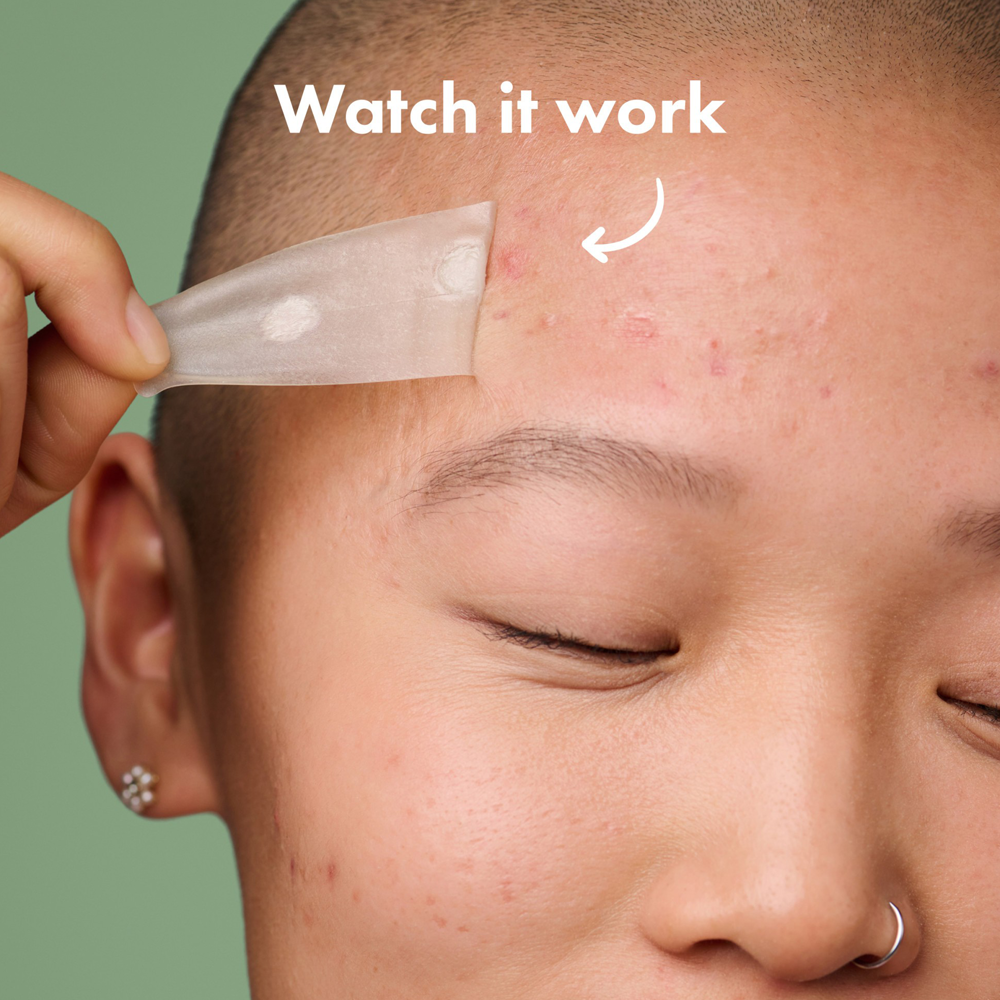 Person applying a patch to their forehead with text 'Watch it work' on a green background