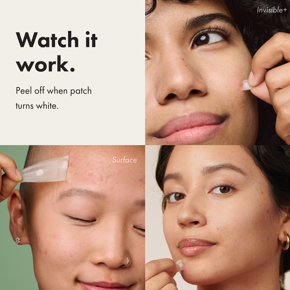Collage of a woman applying a patch to her face with text 'Watch it work. Peel off when patch turns white.'