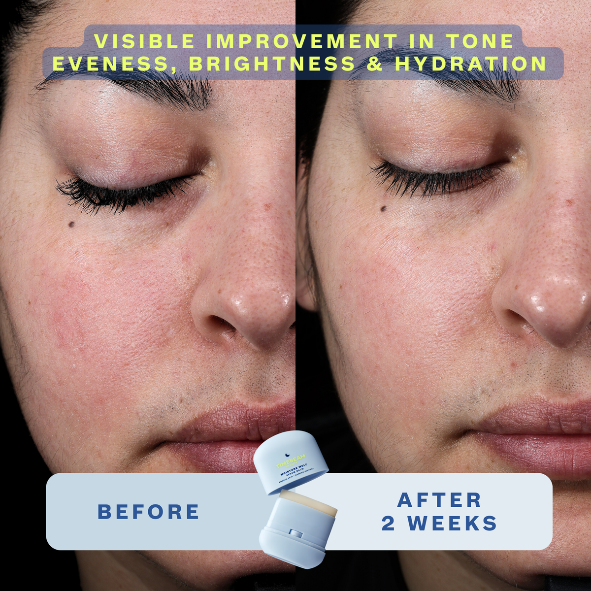 Before and after images of a woman's face showing benefits of regular use of Timebeam Beauty - Moisture Melt Serum Balm after 2 weeks