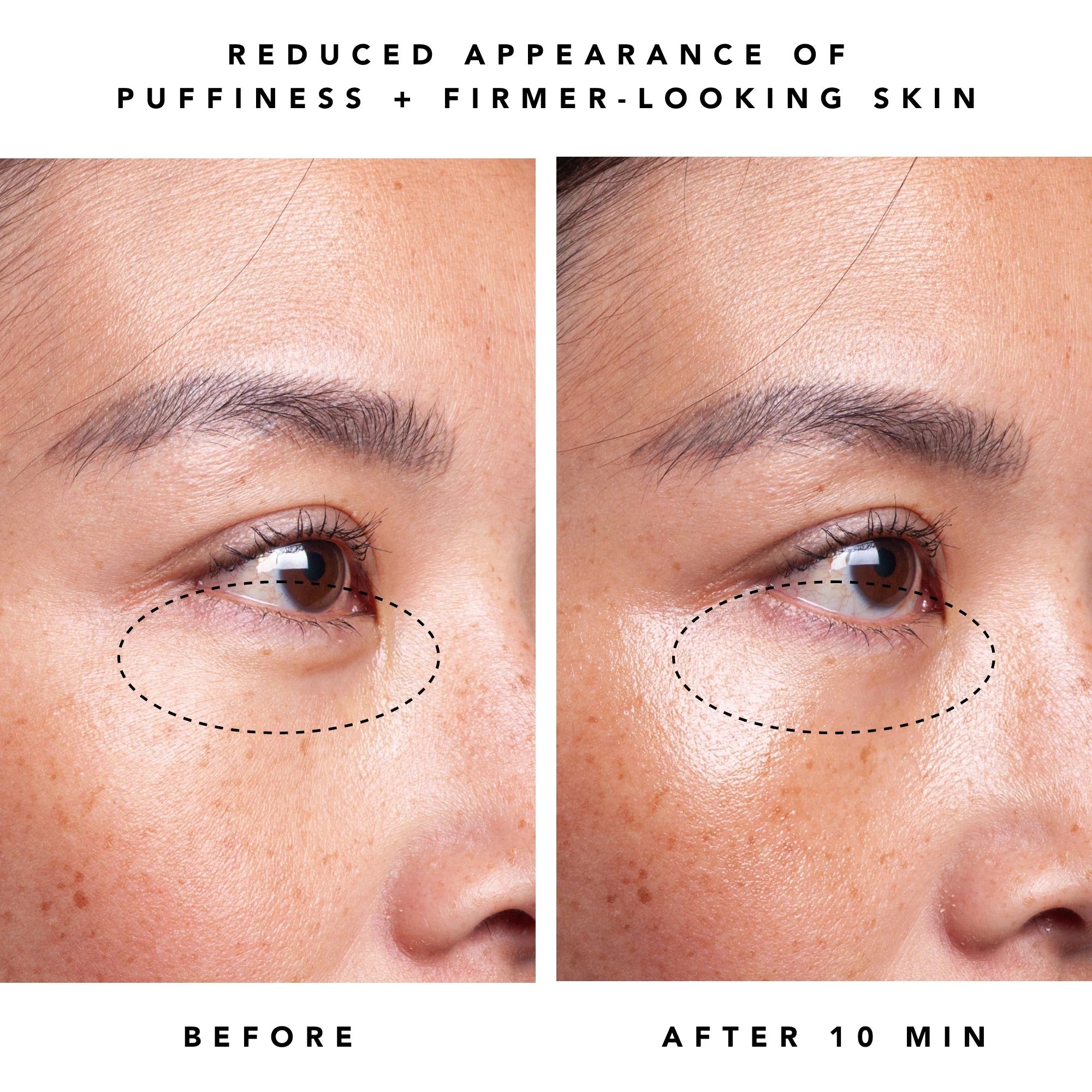 Moon Dew 1% Bakuchiol + Peptides Eye Cream