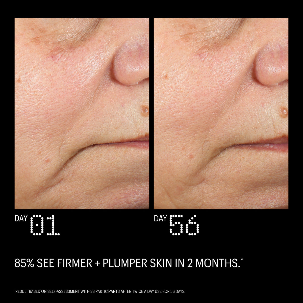Before and after comparison of skin texture on a person's face with text indicating results from a skincare product.