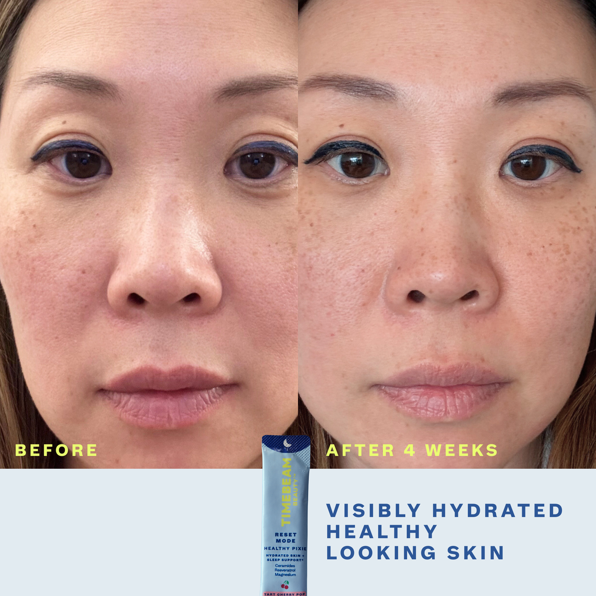 Before and after image of a woman's face showing benefit of regular use of Timebeam Beauty - PM Reset Mode Healthy Pixie 