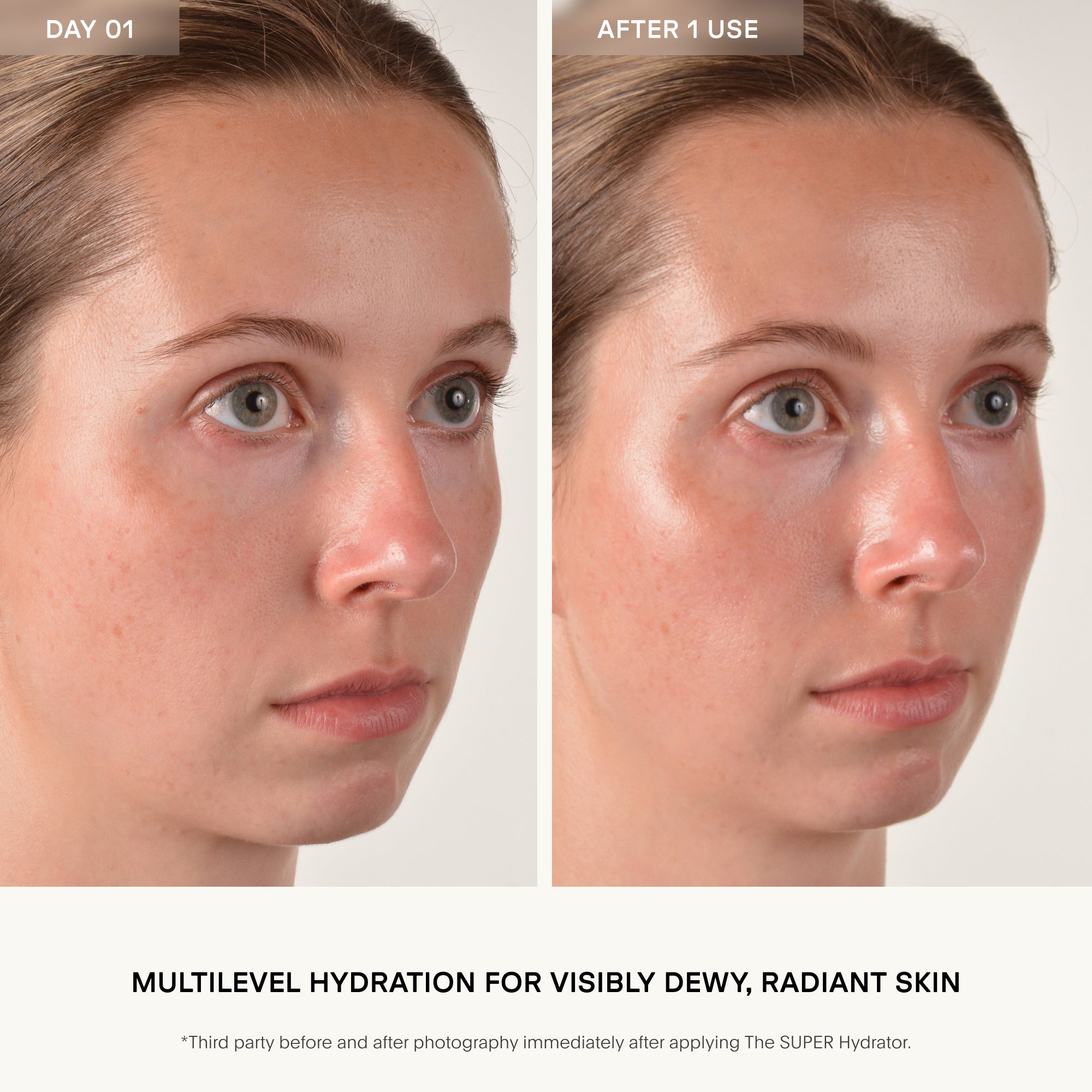 Before and after comparison of a woman's face with text about multilevel hydration for dewy, radiant skin.