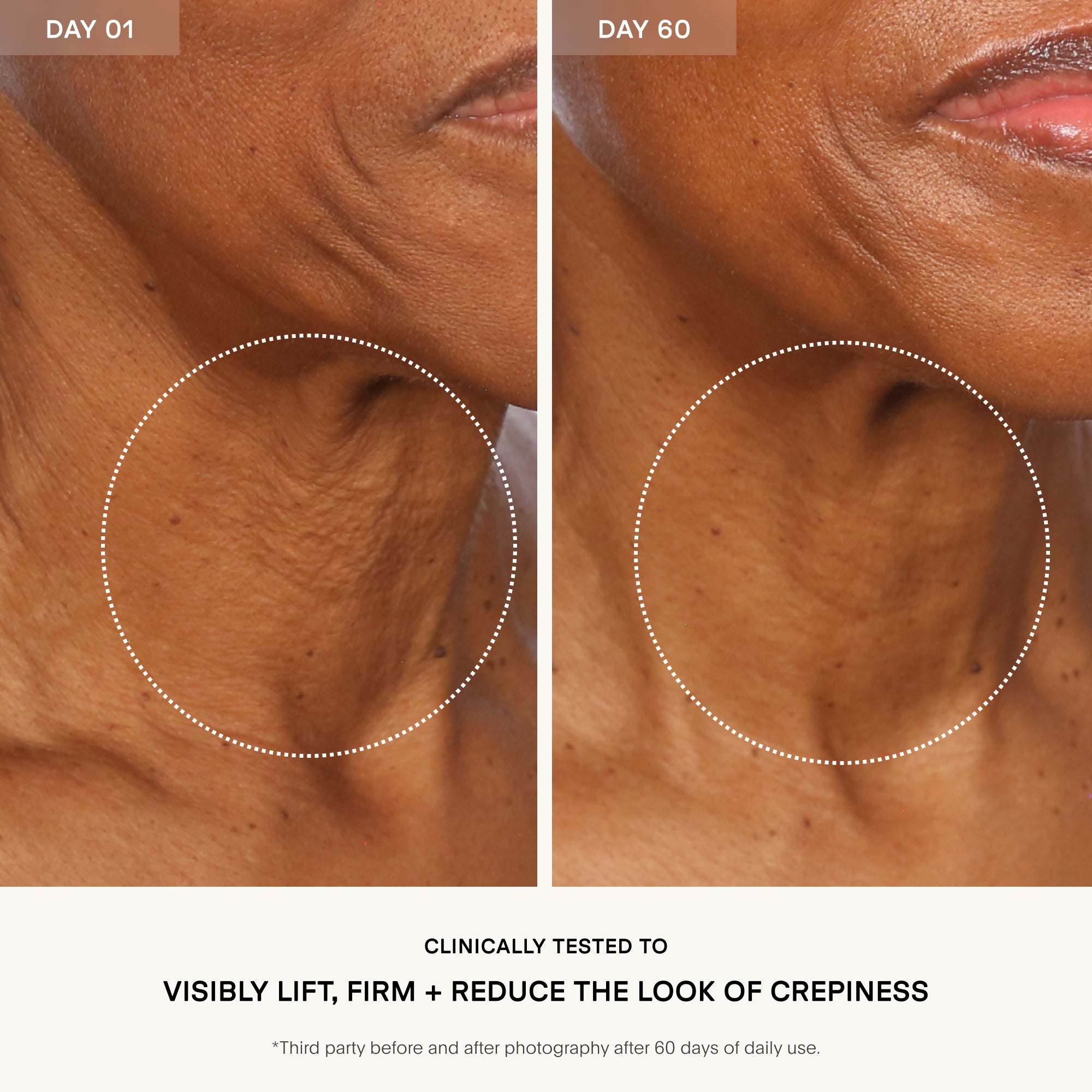 Before and after comparison of skin texture on a person's neck, showing visible improvement over 60 days.