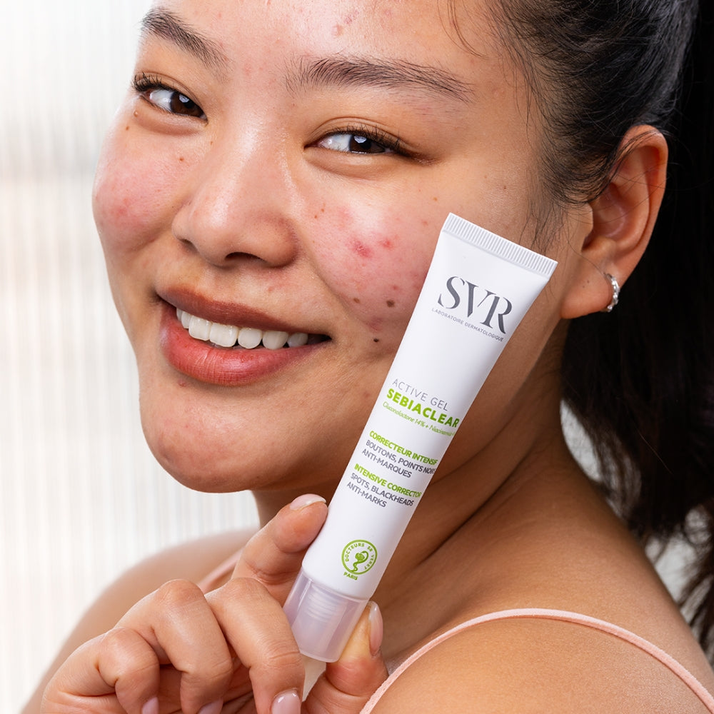Woman holding a tube of SVR Sebiaclear product with visible acne on her face.