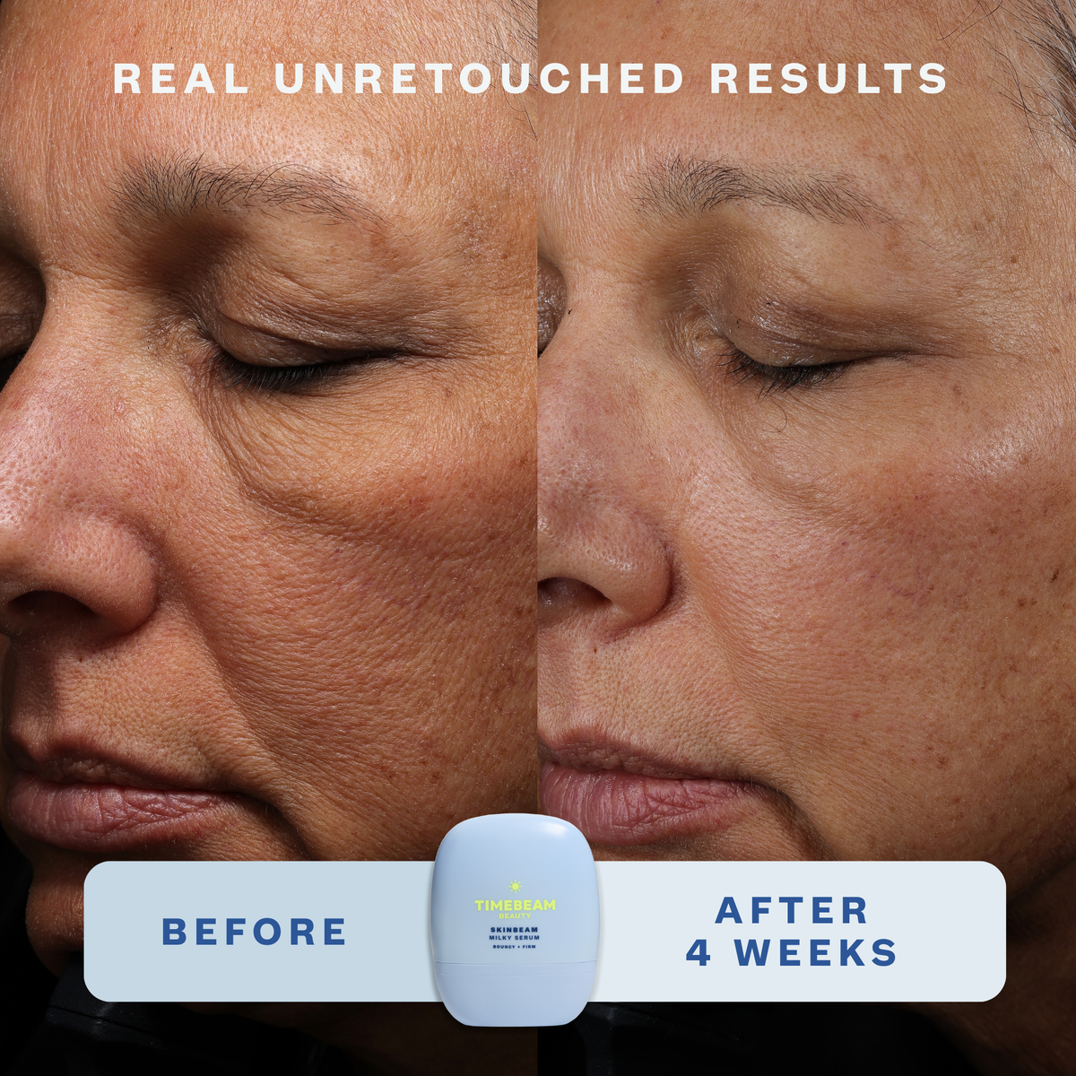 Split screen before & after image showing results of use of Timebeam Beauty - Skinbeam Milky Serum