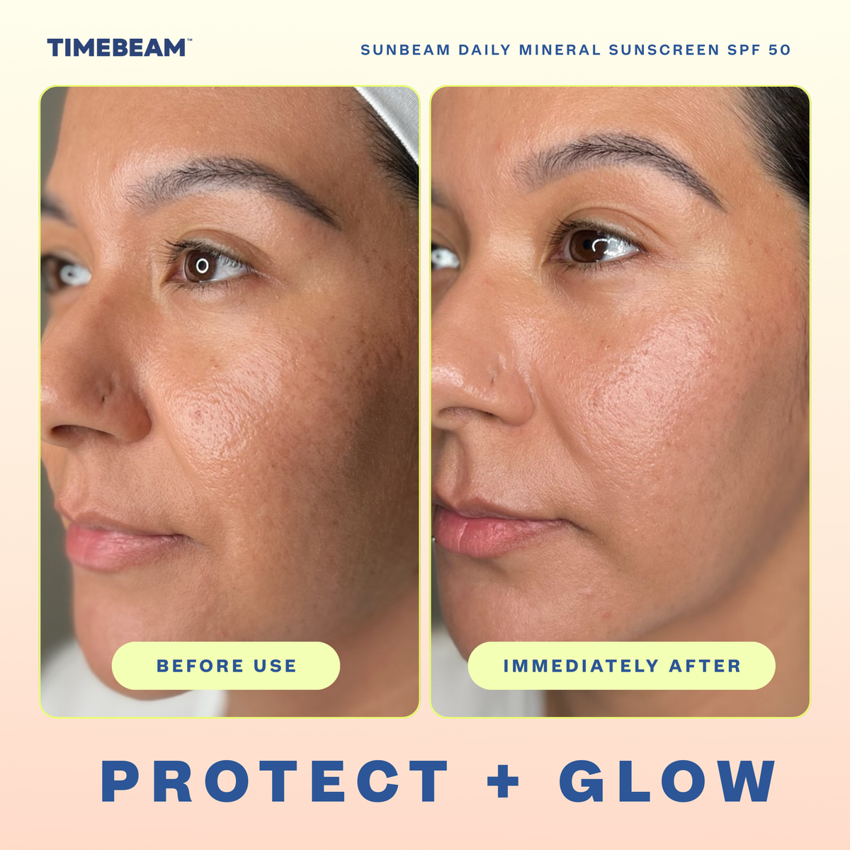 Before and after images of a woman's face showing results of Timebeam Beauty - Sunbeam SPF 50 