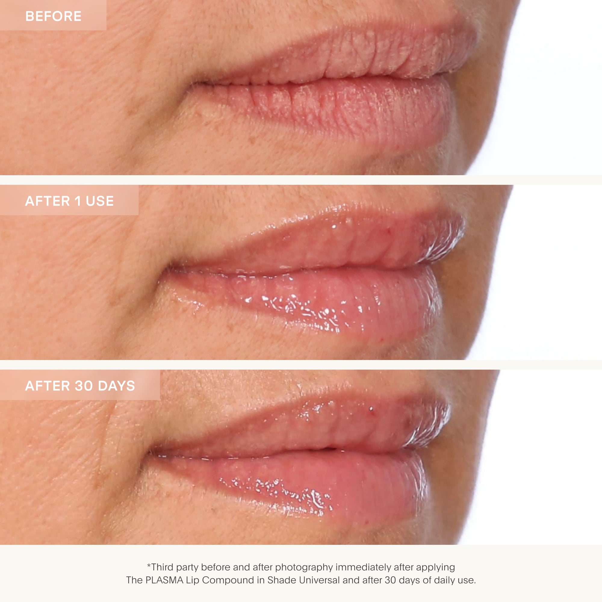Before and after comparison of lips using a lip compound, showing results after one use and thirty days.