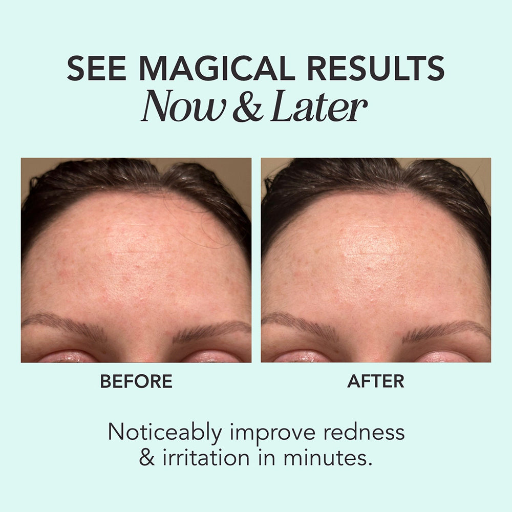 Green Magic Cica + Ceramides Redness Reducing Serum