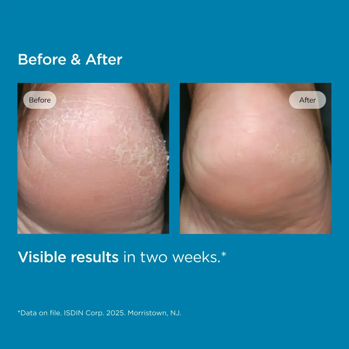 Before & after comparison of skin response to product use