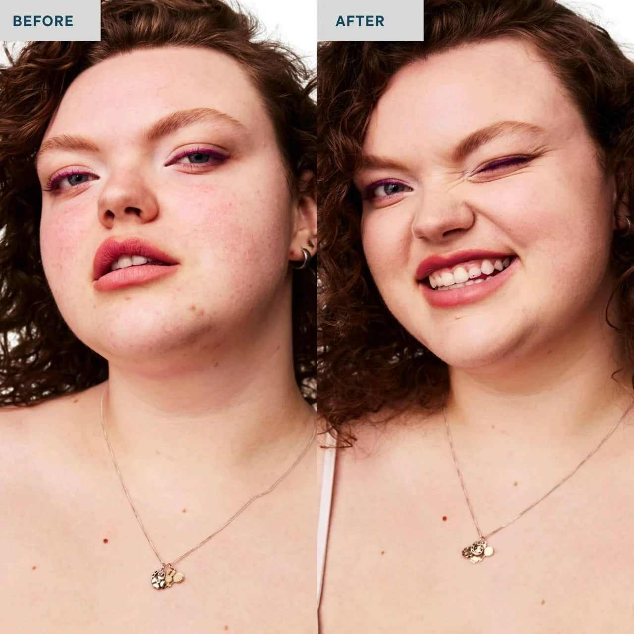 Before and after comparison of a woman's face, showing skin improvement. The left side is labeled 'BEFORE' and shows fuller cheeks and forehead; the right side is labeled 'AFTER' and shows a smoother, clearer complexion.