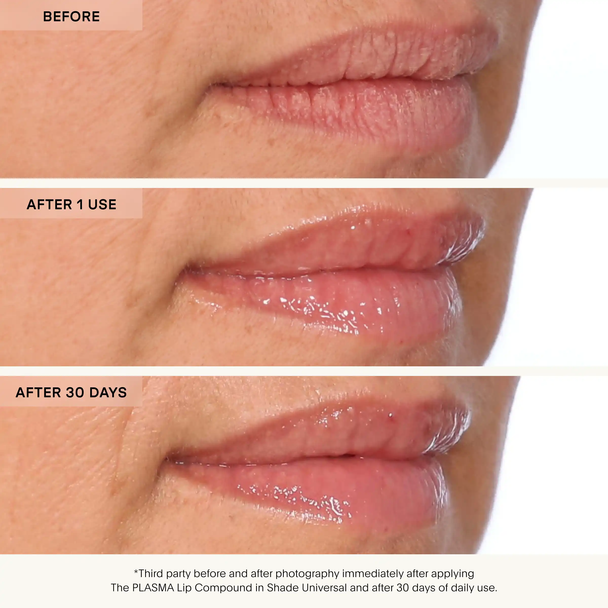Before and after comparison of lips using a PLASMA Lip Compound