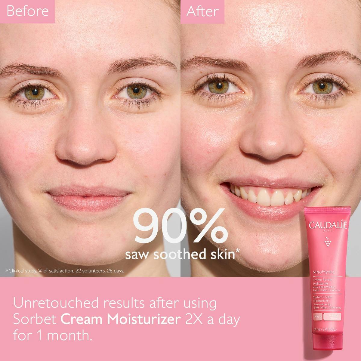 Before and after comparison of a woman's face with Caudalie cream